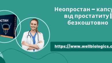 Неопростан відгуки