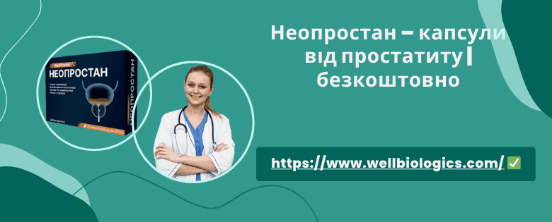 Неопростан відгуки