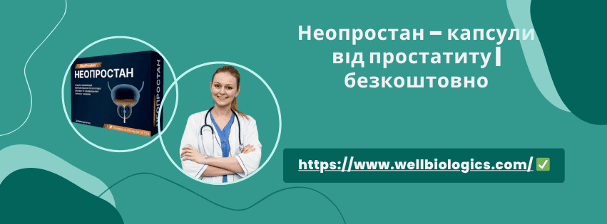 Неопростан відгуки