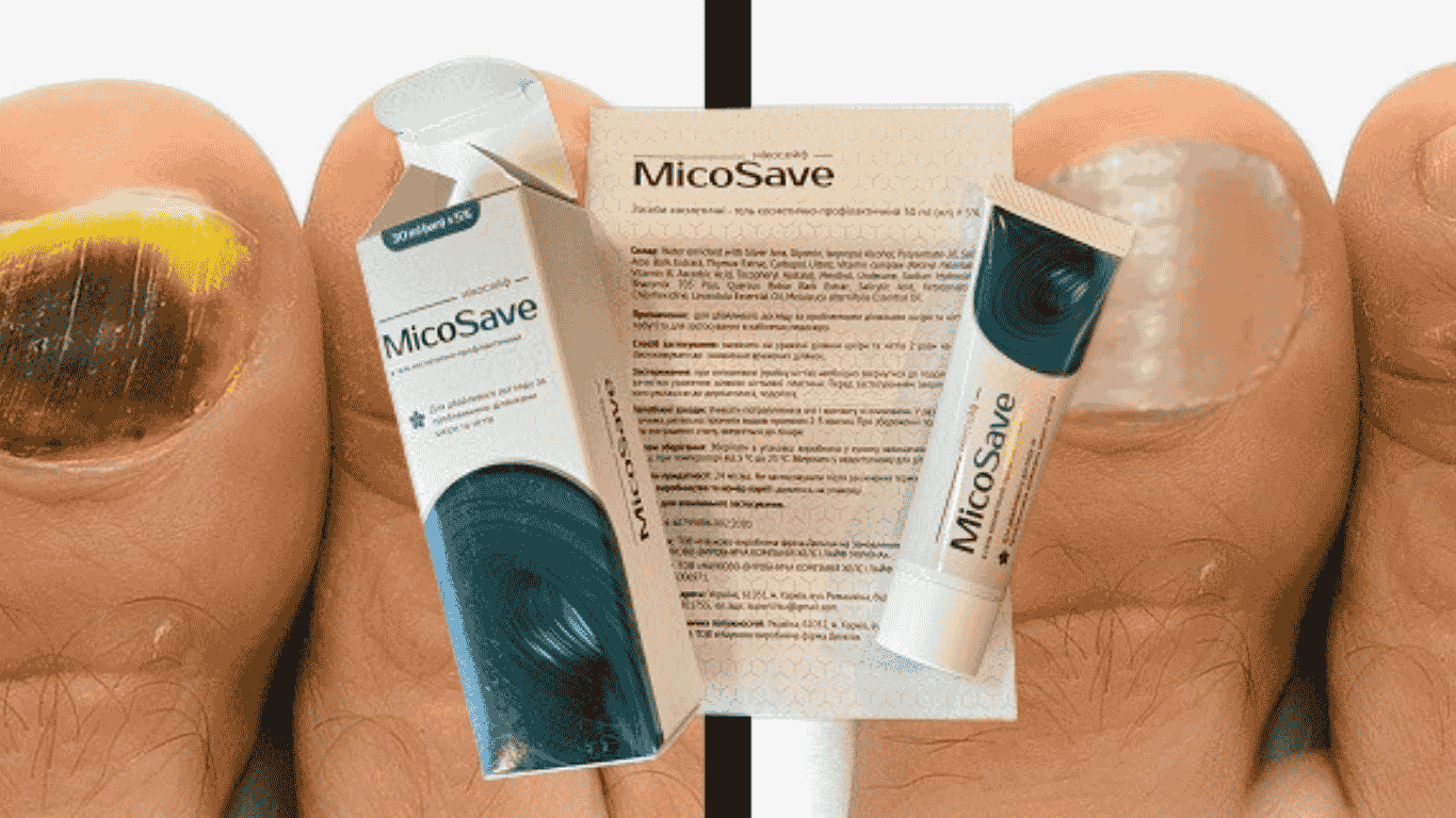 MicoSave відгуки
