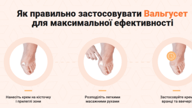 Valguset відгуки