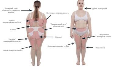 Candy Slim відгуки